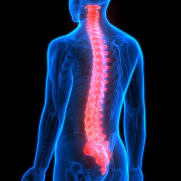 The human spine can cause back pain